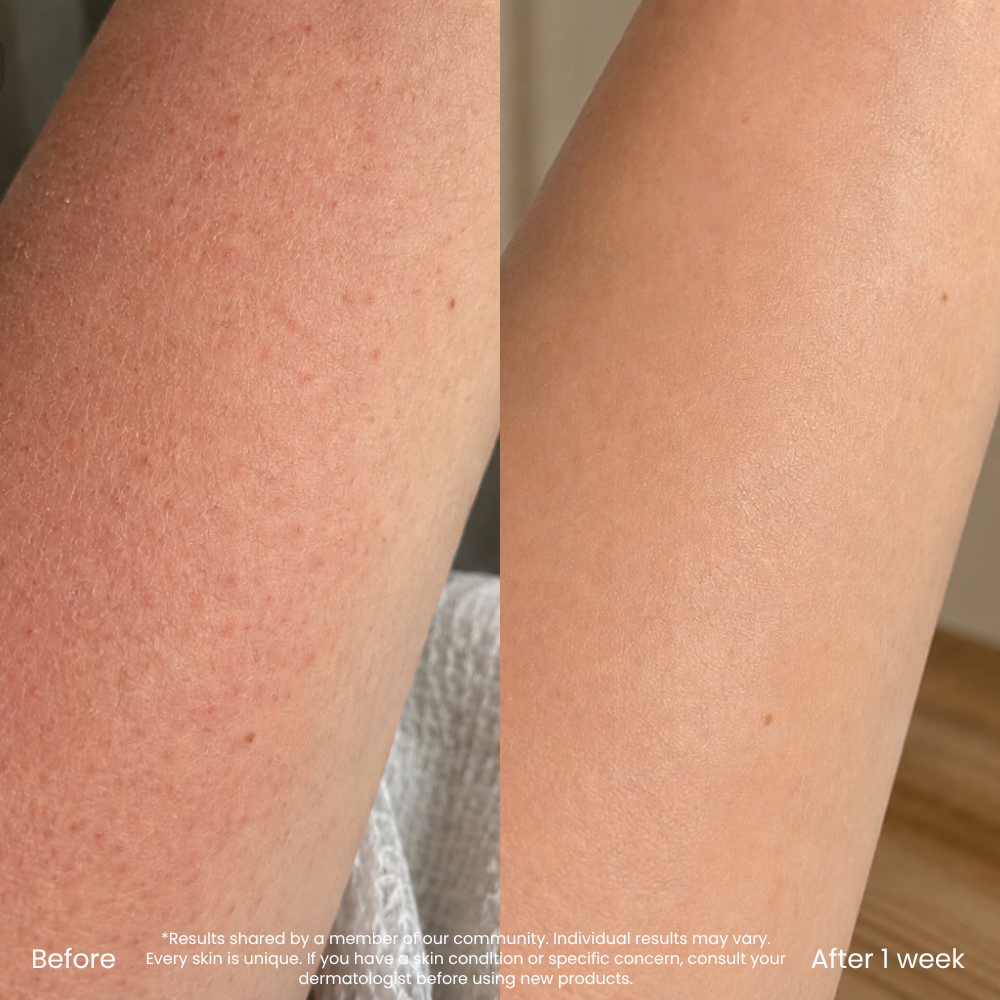 Hyaluronic Acid Hydrating Body Lotion For Dry Skin