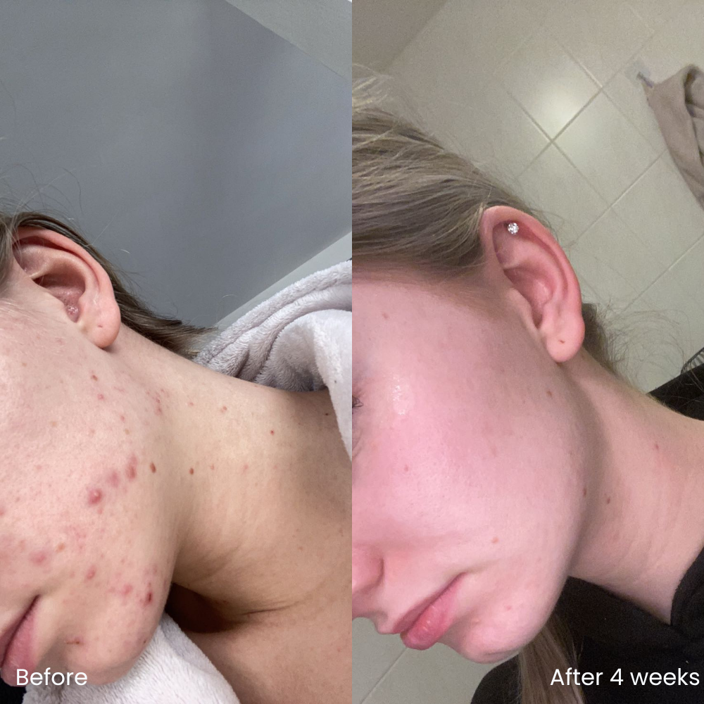 Barrier repair serum