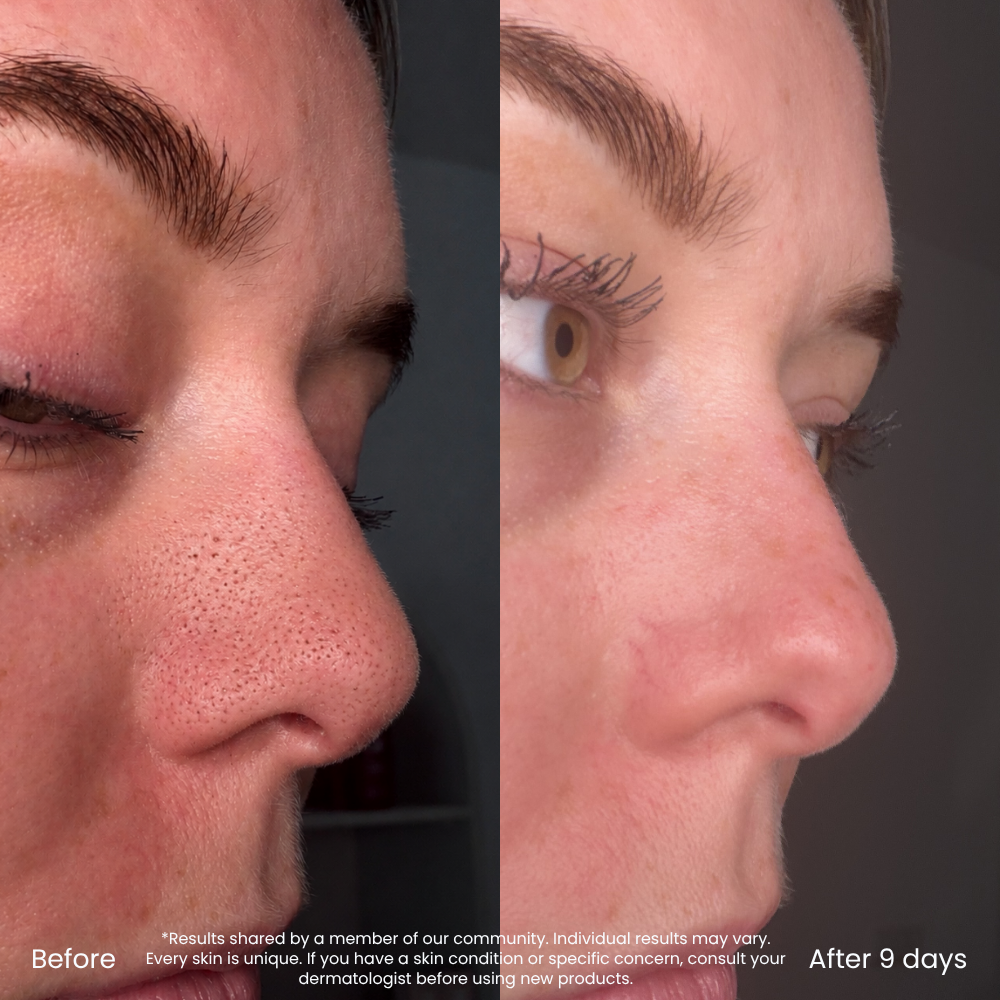 Detoxifying Clay Mask For Pores & Excess Oil