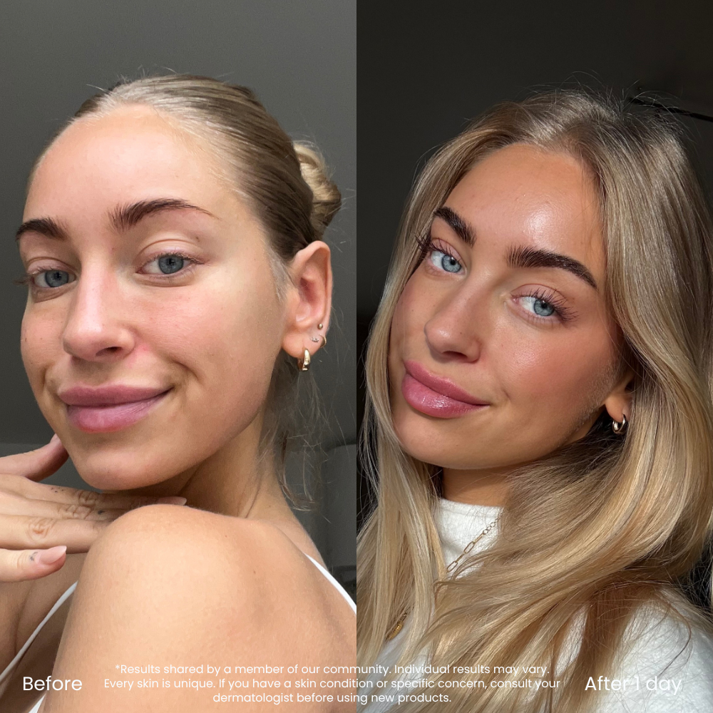 Hyaluronzuur Zelfbruiningsdruppels Voor Een Natuurlijke Glow
