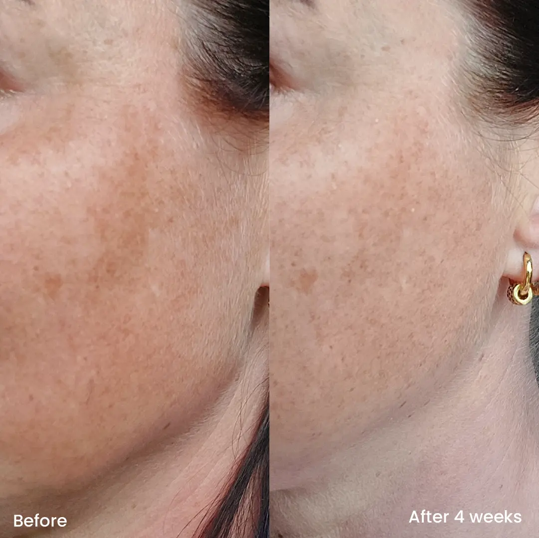 2% hyaluronic acid serum