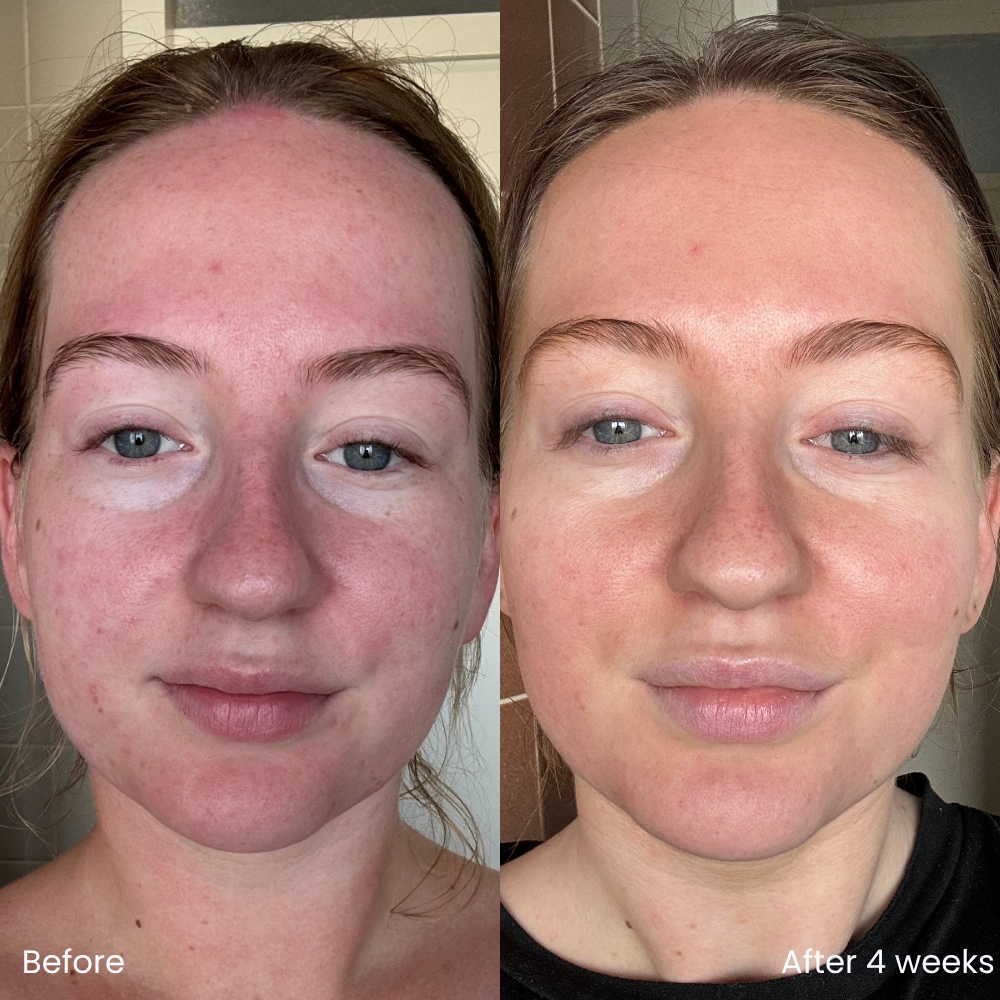 Hydrating moisturizer