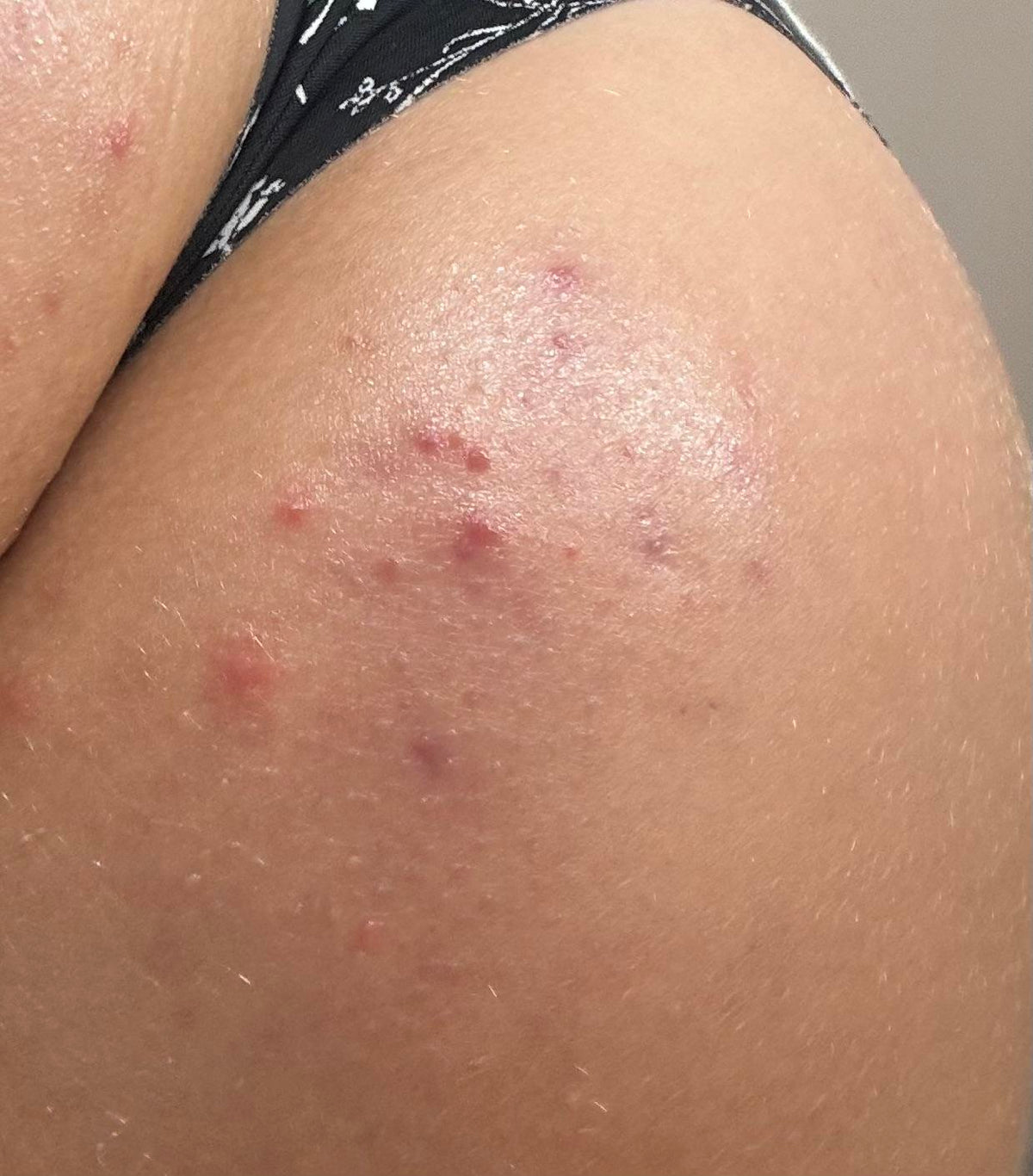 Day 1